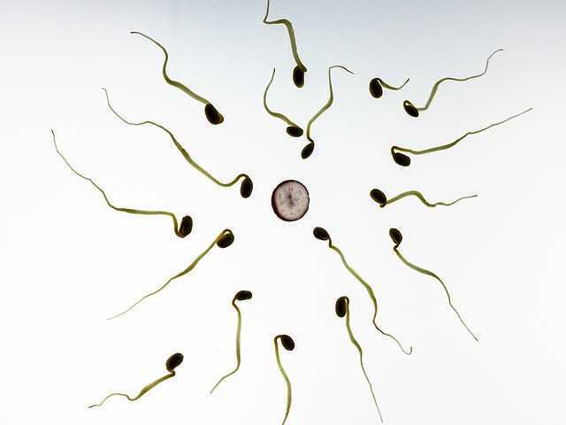 Testicular Cancer: Seeking to Spare the Sperm